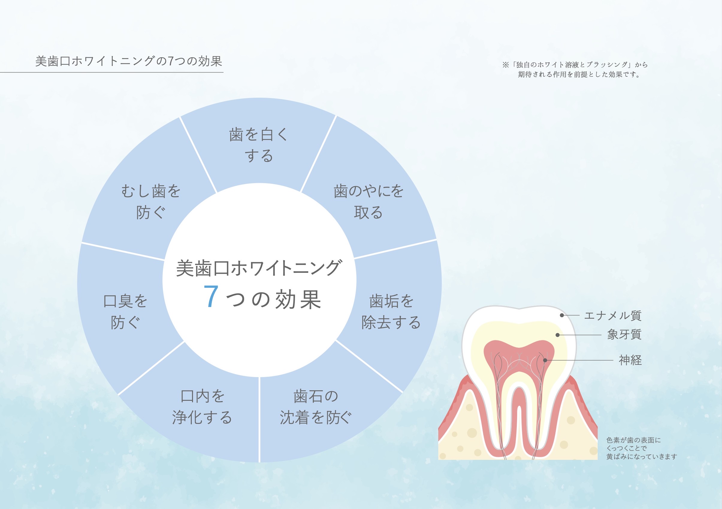 セルフホワイトニング